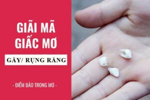 Giải mã giấc mơ bị rụng răng? Điềm báo lành hay điềm báo dữ?